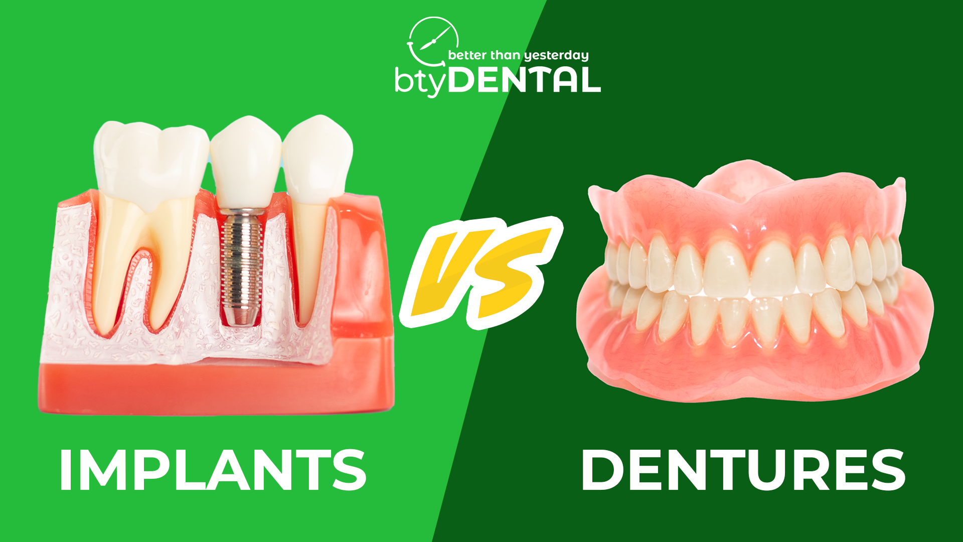 Dentures vs Implants. Here's how to know which one to get.