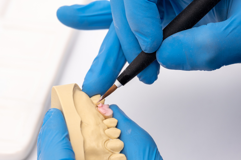 Dental technician working on prosthetic teeth - Dentist in Bonney Lake WA Close-up of hands wearing blue gloves sculpting a dental prosthesis model, representing restorative dentistry - Dentist in Bonney Lake WA