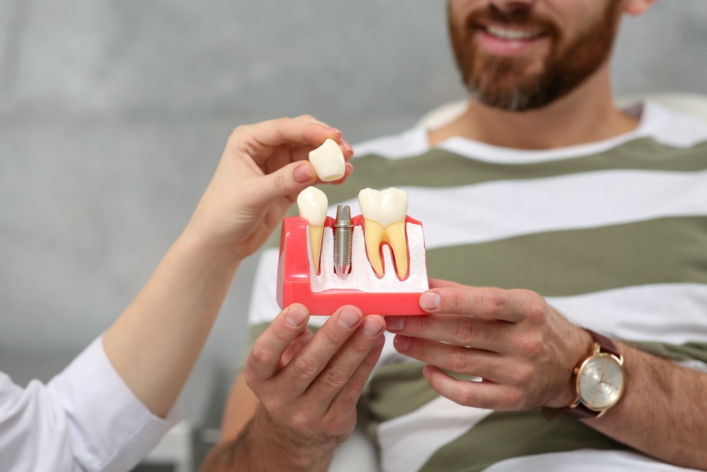 What are Dental Implants? 3 Common Types of Implants