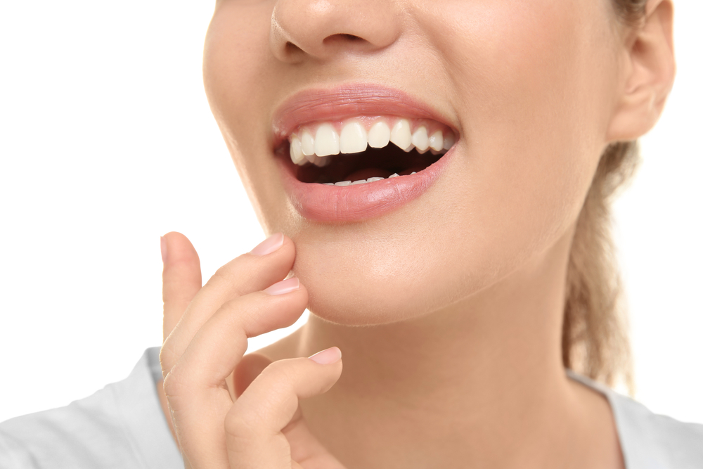 Woman with perfect teeth smiling - Dental Bonding Woman with perfect teeth smiling - Dental Bonding