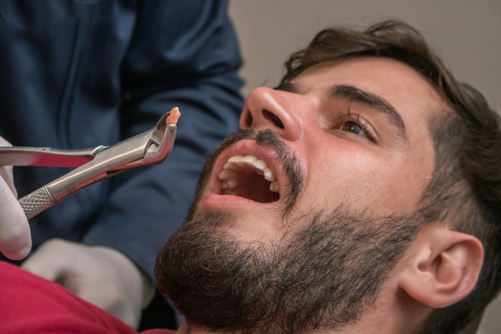 Male patient having a dental extraction - Dentist in Lynnwood WA Male patient having a dental extraction - Dentist in Lynnwood WA