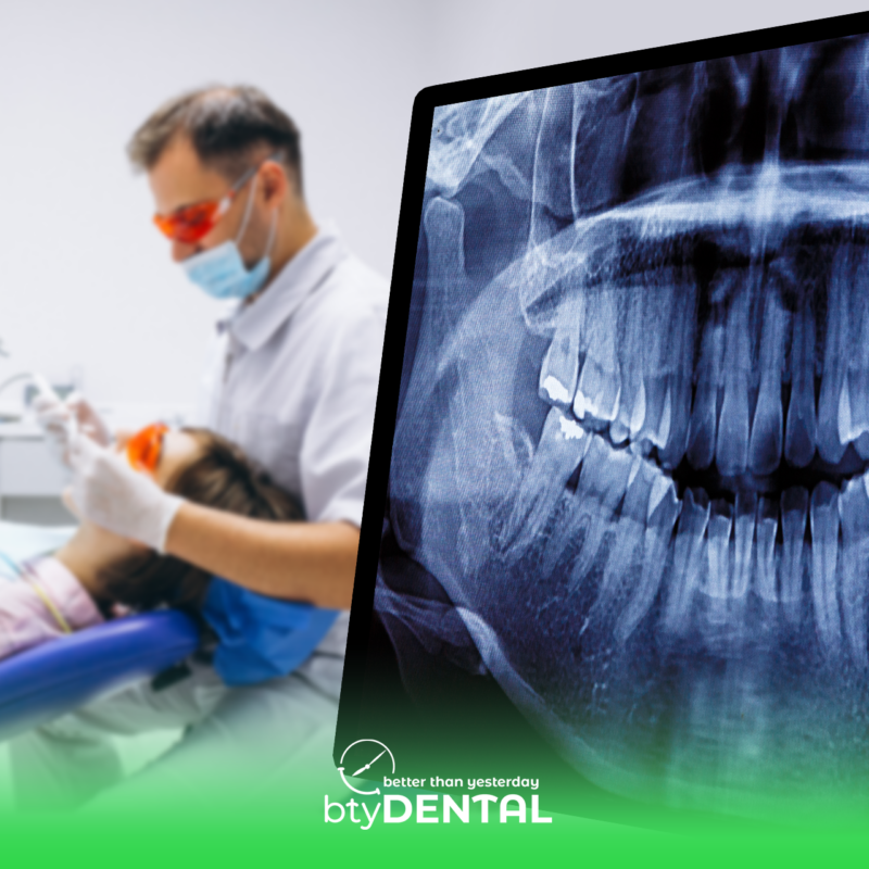 RCT alternatives in Washington