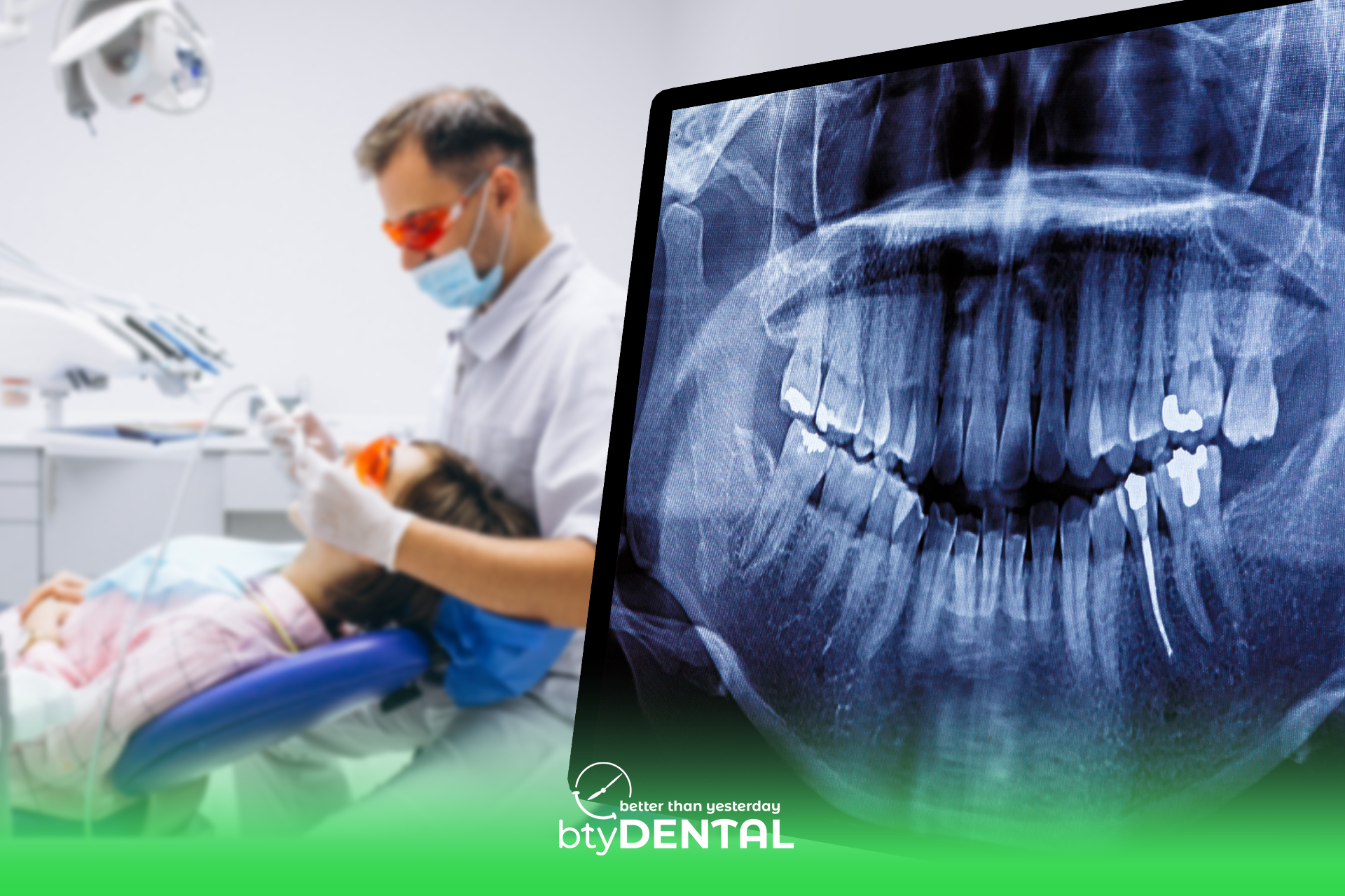 RCT alternatives in Washington